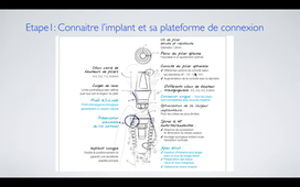 Selection et Commande de Matériel Implantaire Partie 1.mp4