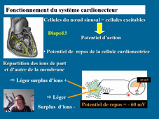 SCV systeme cardionecteur.mp4