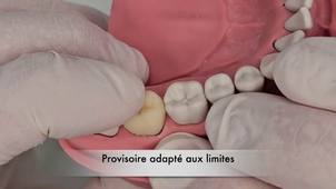 TUTO RÉGLER UN SOUSCONTOUR.mp4