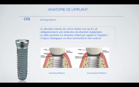 Implant , connectique et Accastillage Implantaire .mp4